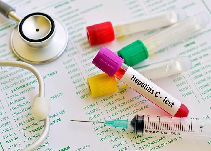 HEPATITE ZERO: Rotary Club realiza campanha com testes gratuitos em Porto Velho