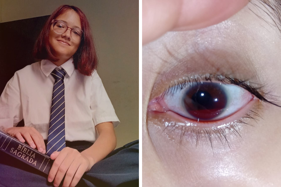 APELO: Mãe faz vaquinha para impedir cegueira da filha 