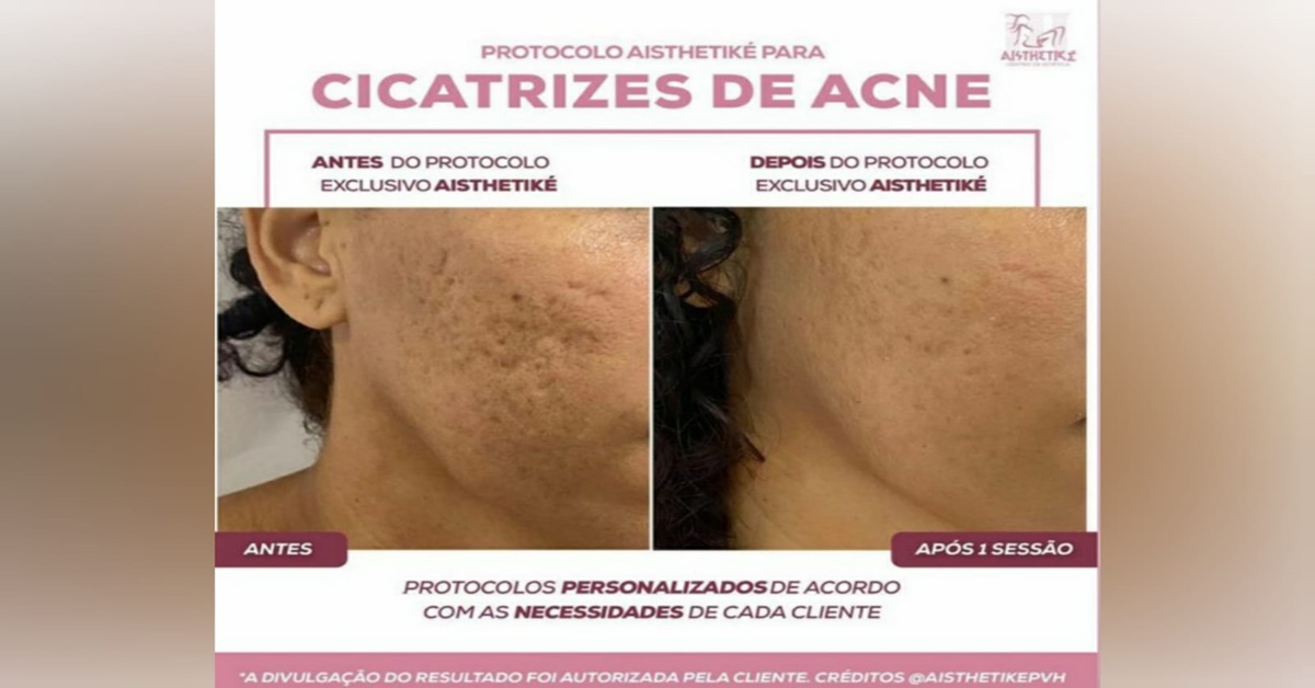 ESPECIAL DE FEVEREIRO: Confira as promoções imperdíveis da Clínica Aisthetiké