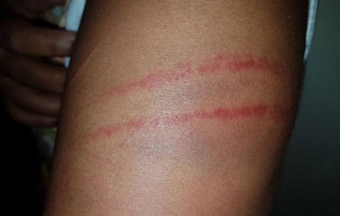 NO CARRO: Mulher é agredida e torturada ao aceitar carona do ex-marido