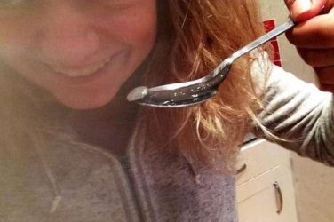 'Mochileira' encontra sanguessuga de 7 cm dentro do nariz

