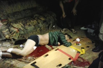 TOCAIA - Foragido da justiça é pego de surpresa e baleado na porta de casa
