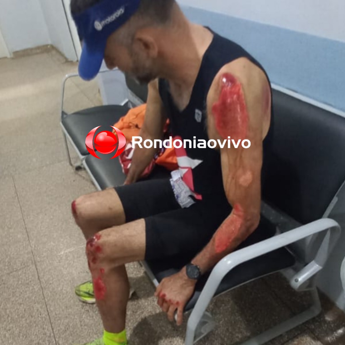 NA CHUVA: Jornalista Pedro Silva sofre grave acidente na Avenida Santos Dumont 