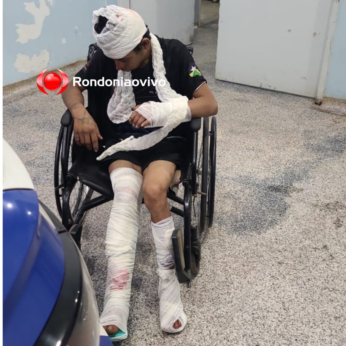 CASTIGADO: Ladrão fica todo quebrado após sofrer queda durante furto em panificadora 