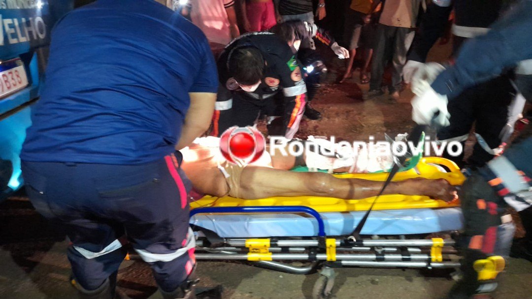 GRAVÍSSIMO: Pedestre tem perna dilacerada ao ser atropelado por ônibus 