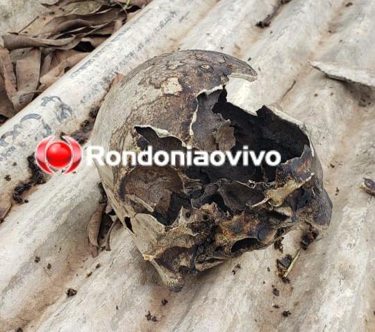 CARBONIZADO: Homicídios é acionada após crânio humano ser encontrado em fazenda