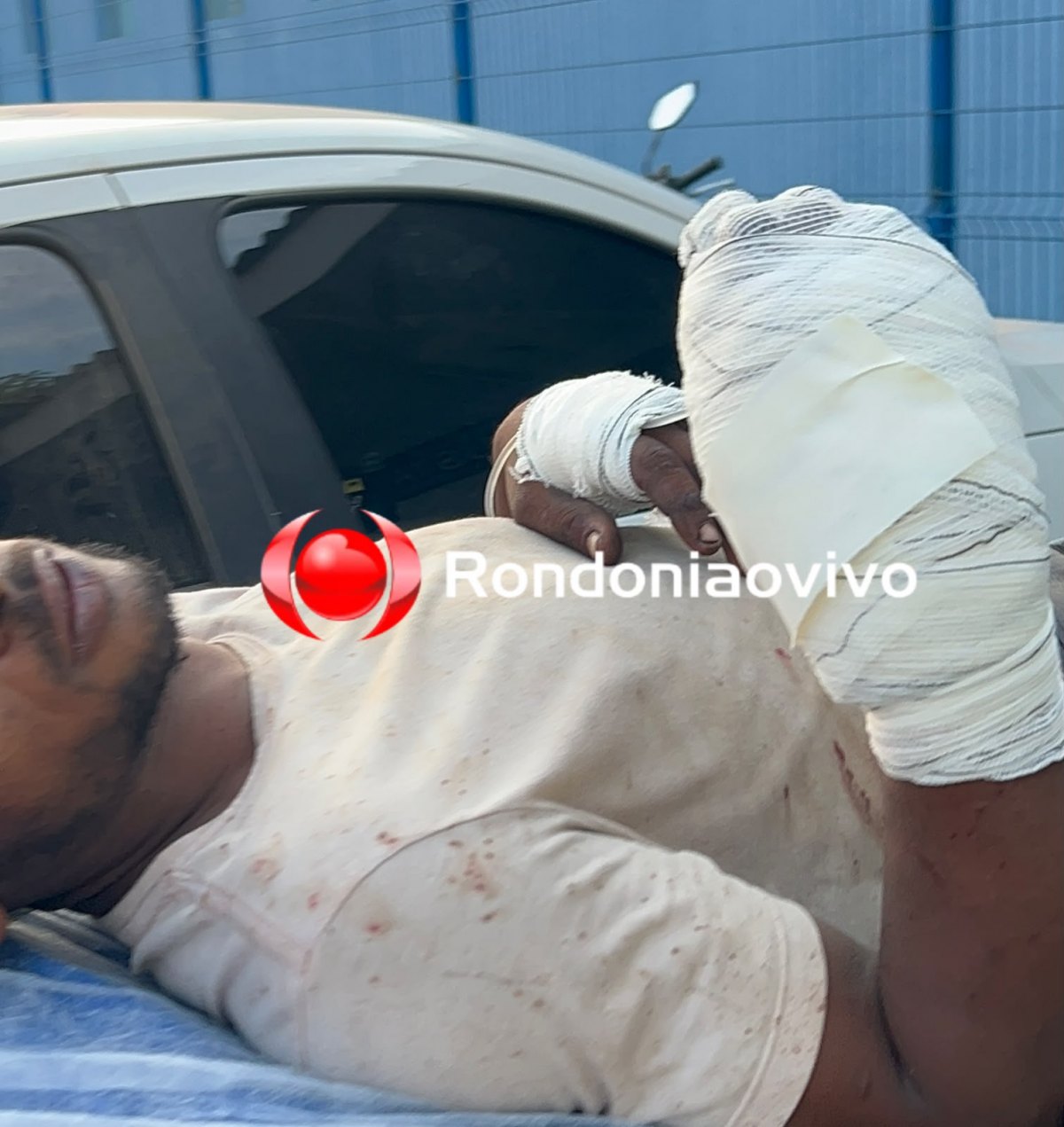 'DON JUAN': Homem tem dedo decepado por acusado com ciúmes de mulher