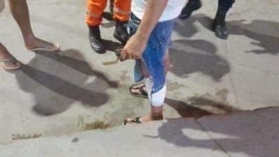 'BANDO DO CARAMELO': Homem é salvo por policial após sofrer ataque de cachorros na Jorge Teixeira 