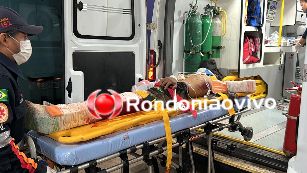 MOTORISTA FUGIU: Adolescente sofre traumatismo craniano e fraturas após atropelamento na BR-364