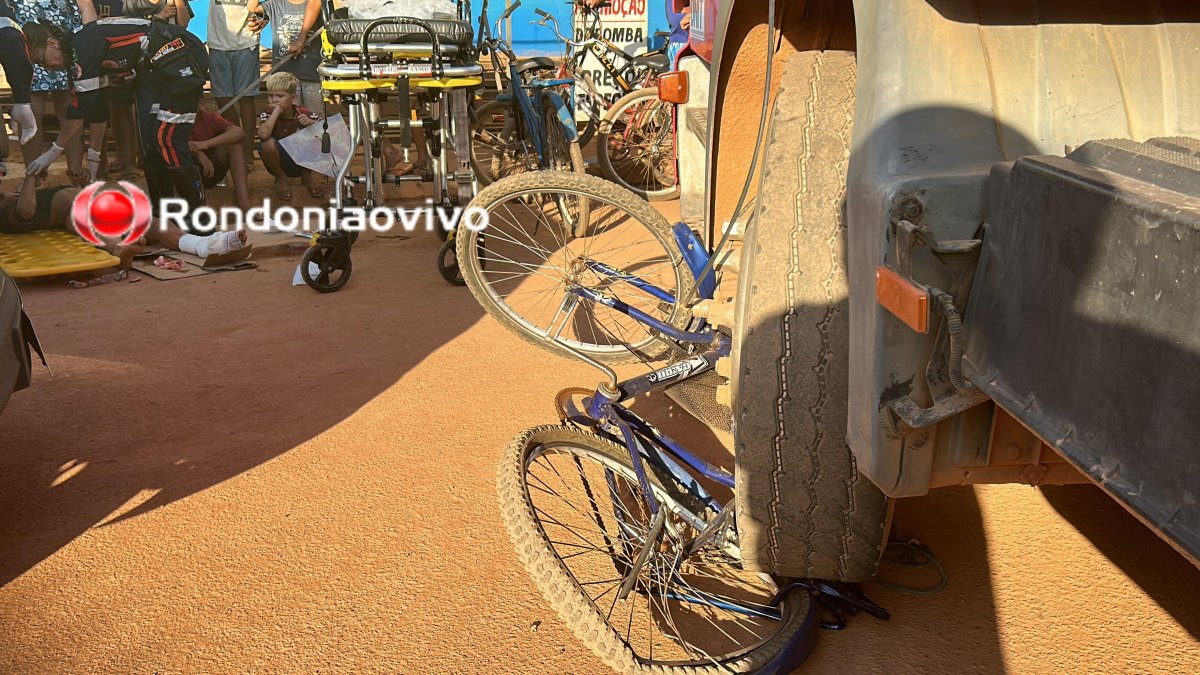 NA AMADOR: Menina de 13 anos tem perna dilacerada em gravíssimo atropelamento