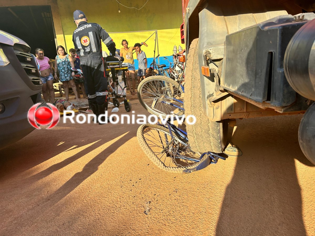 NA AMADOR: Menina de 13 anos tem perna dilacerada em gravíssimo atropelamento