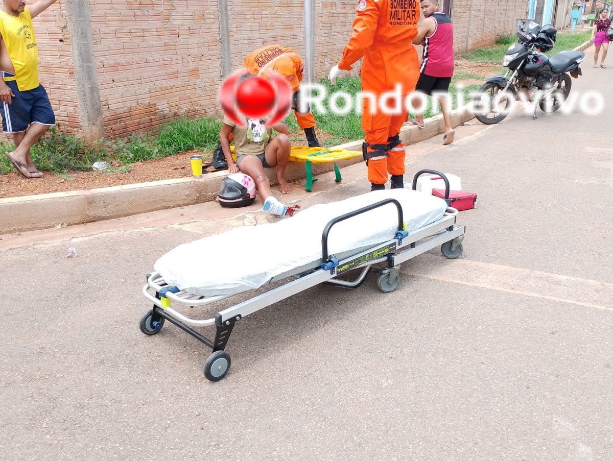 EXPOSTA: Mulher tem grave fratura após avançar a preferencial com motocicleta