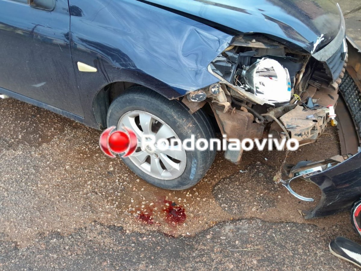 URGENTE: Mulher sofre fratura exposta em grave acidente na zona Sul