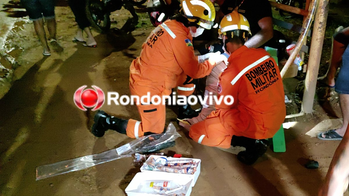 VÍDEO: Motociclista sofre grave fratura após colisão frontal na Petrolina 