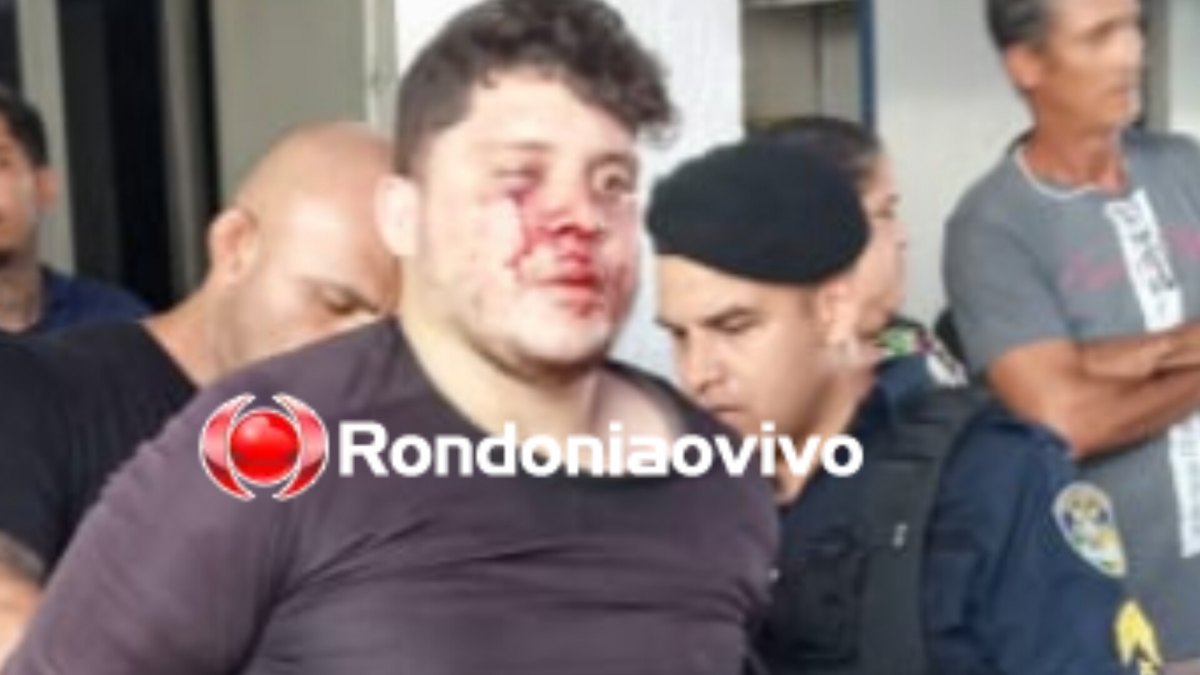 AGRAVOU: Assistente social atacada pelo ex é intubada e transferida para a UTI