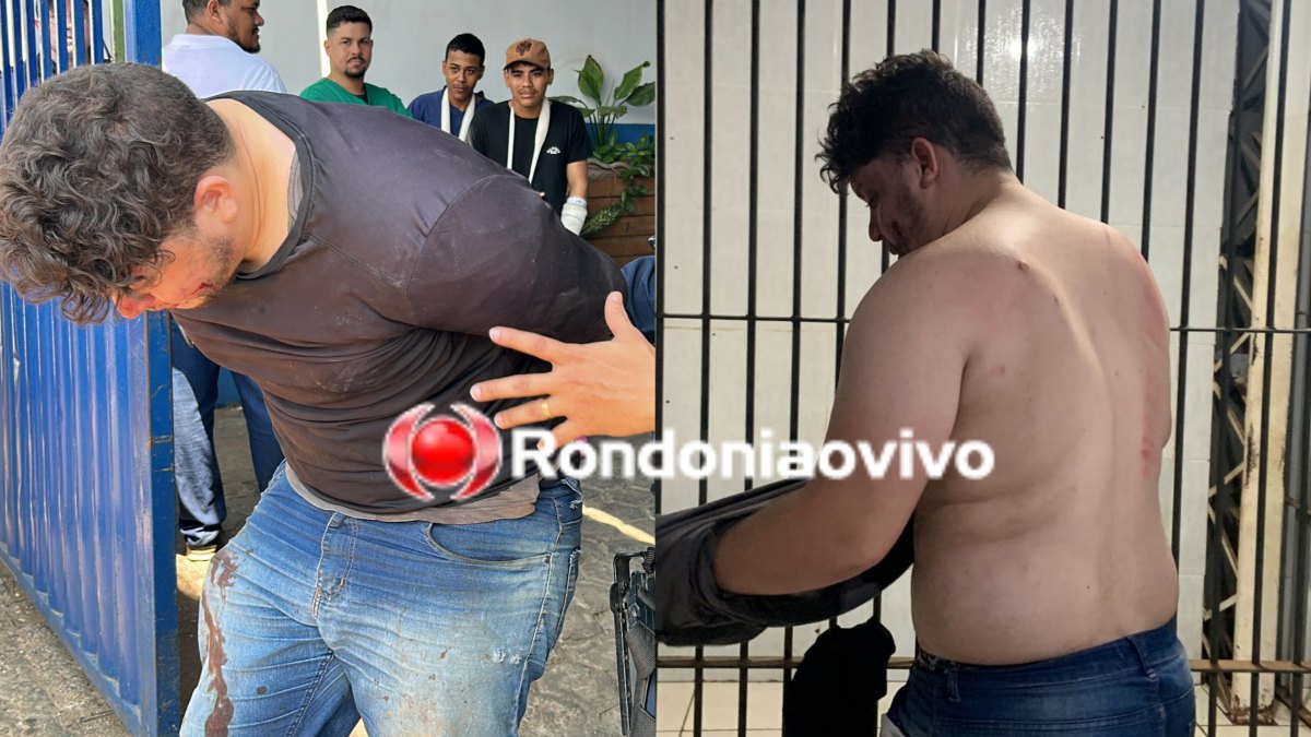 AGRAVOU: Assistente social atacada pelo ex é intubada e transferida para a UTI