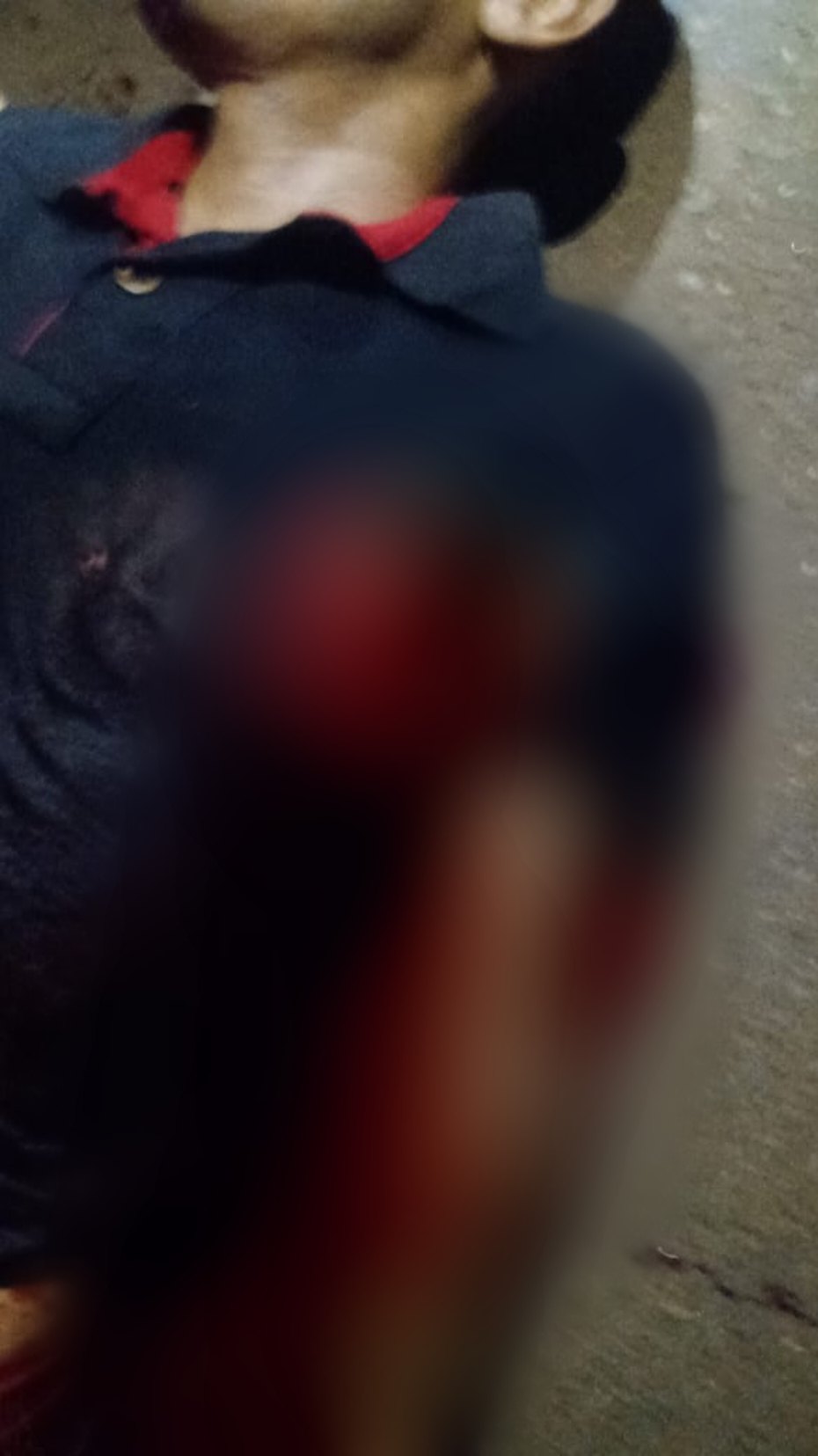 ARRASTADO: Ciclista fica gravemente ferido ao ser atropelado por dois veículos