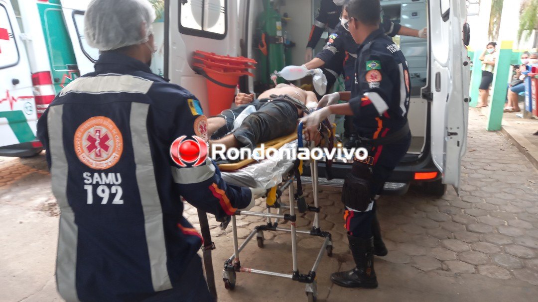 CASTIGADO: Assaltante rouba moto e na fuga fica em estado grave  ao se chocar contra muro