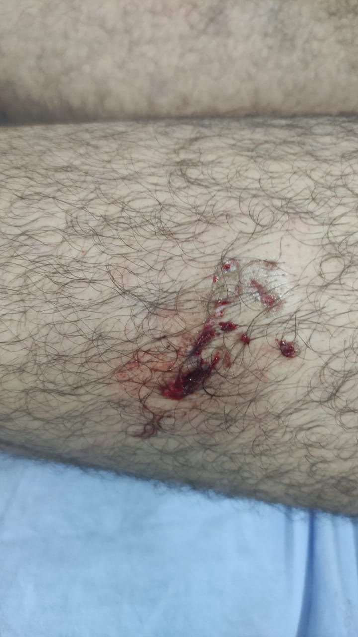 COLETA DE LIXO:  Empresa RLP clama por conscientização da comunidade sobre os cuidados com os cães