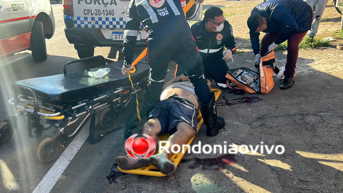 VÍDEO: Motociclista tem perna dilacerada em gravíssimo acidente