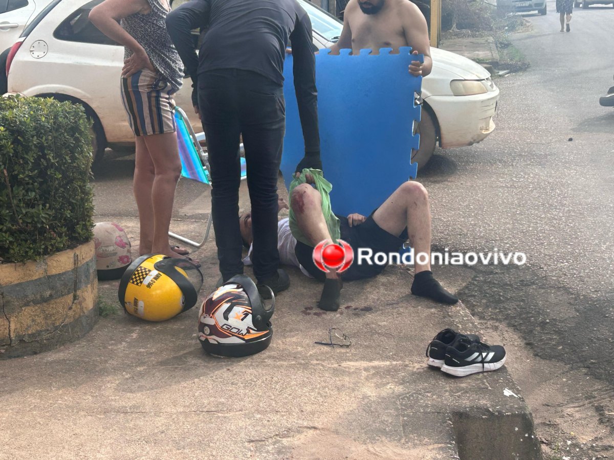 VÍDEO: Motociclista tem gravíssima fratura exposta em acidente