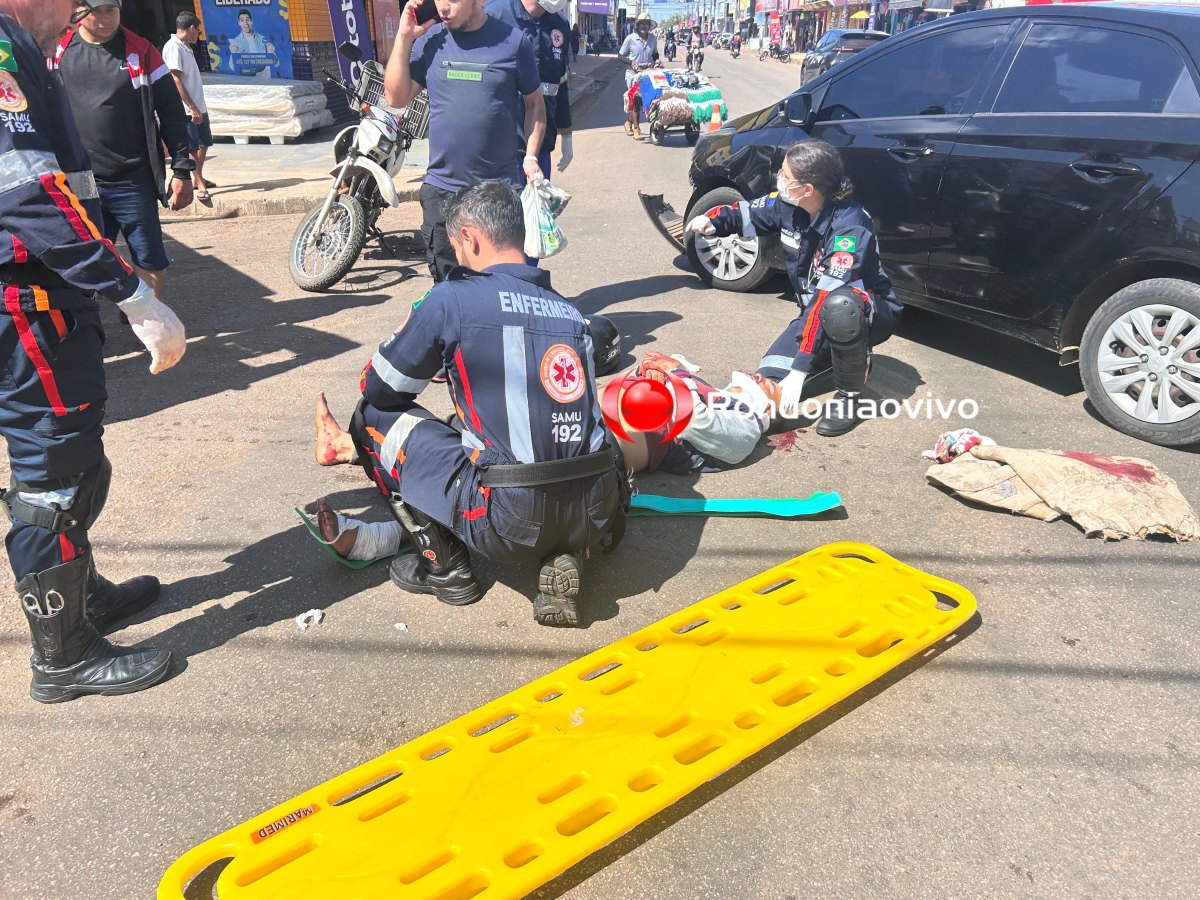 DE FRENTE: Vídeo registra grave acidente frontal entre moto e carro na Amador dos Reis 