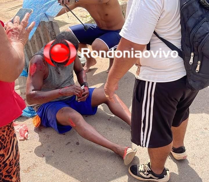 URGENTE: Motociclista fica seriamente ferido ao perder o controle em quebra-molas 