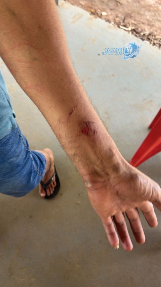 CURVA DA MORTE: Ônibus com 28 passageiros é atingido por caminhão na BR-364