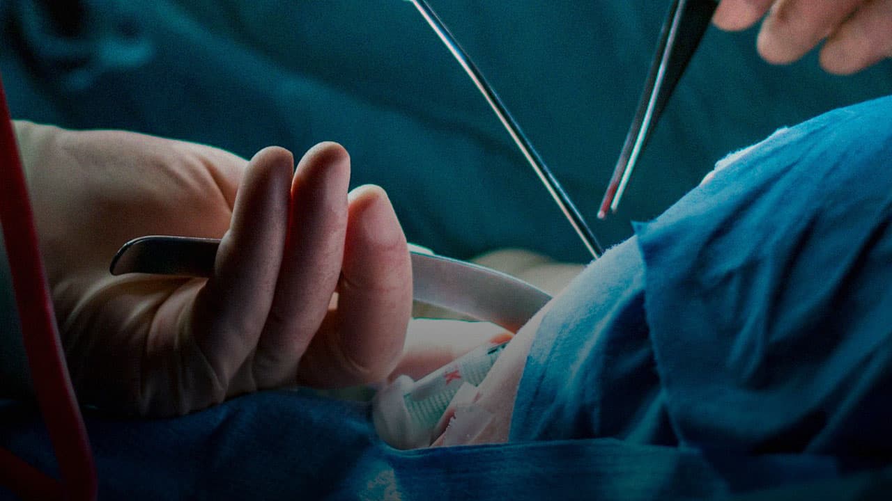 DECISÃO: Plano de saúde tem que cobrir cirurgia de mudança de sexo, diz STJ