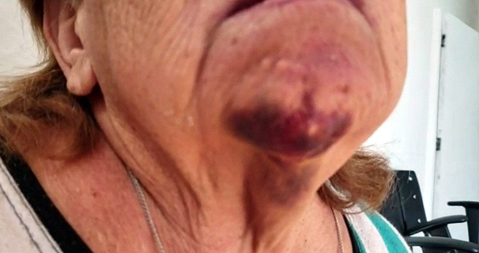 BRUTALIDADE: Mãe é agredida, jogada ao chão e tem rancho roubado pelo filho