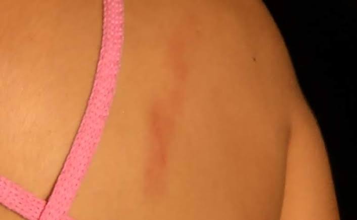 ALUCINADO: Jovem 'naqueles dias' é abusada e espancada pelo marido 