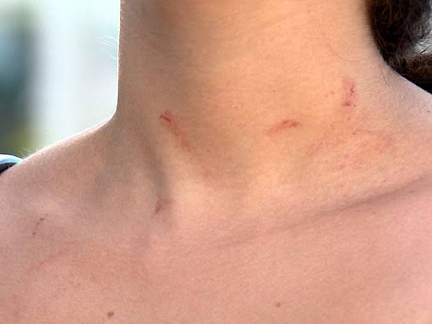 NÃO GOSTOU: Mulher é agredida ao chegar do hospital e encontrar marido usando droga