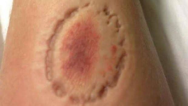 BRUTALIDADE: Pai defende a nora de agressão e é atacado a mordidas pelo filho