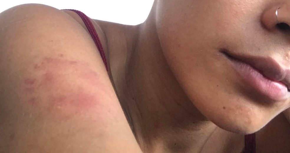 HOSPITALIZADA: Mulher apanha do marido dentro de carro e ao chegar em casa leva surra da irmã 