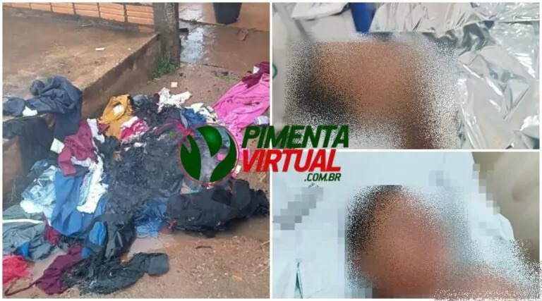 TRAGÉDIA: Mulher ateia fogo em si, na companheira e na casa após discussão 