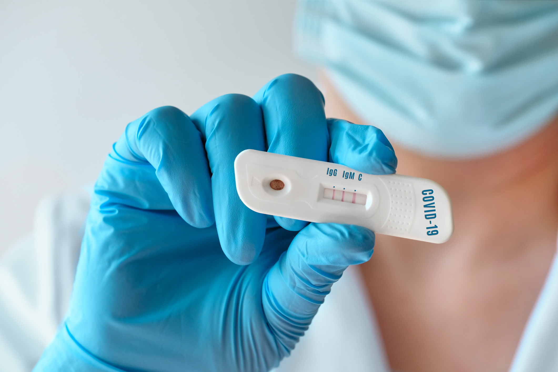 CORONAVÍRUS: Rondônia registra três mortes e 1.613 casos em apenas um dia