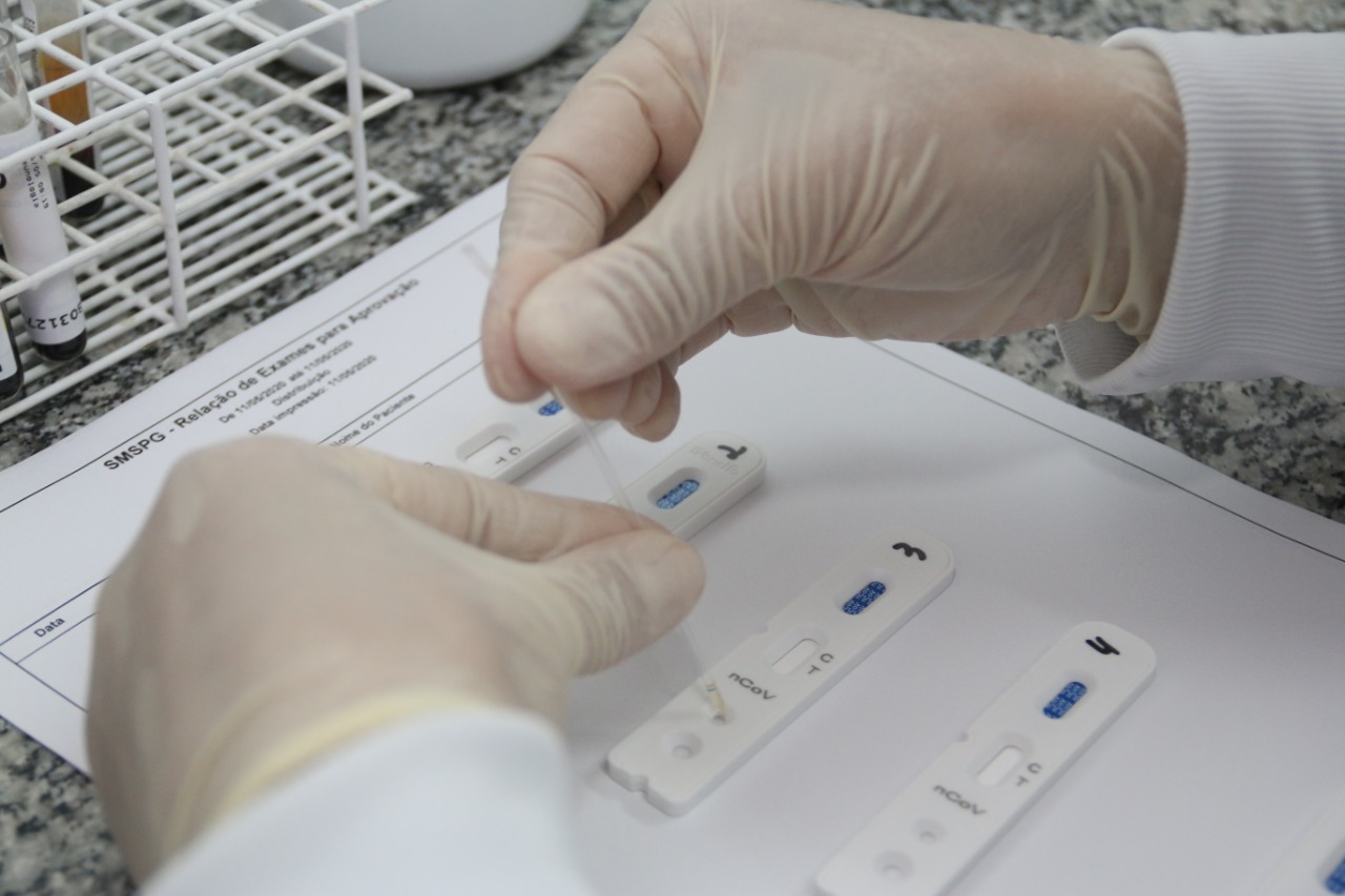 Em três dias, Rondônia tem duas mortes e quase 2.500 casos de covid-19