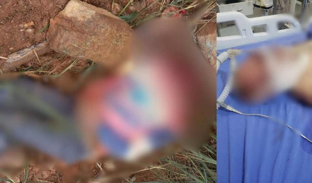 INTUBADO: Idoso é socorrido em estado grave após ser vítima de espancamento